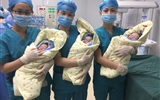 兰大二院产科喜迎2017年首例三胞胎