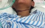七岁女童模仿电视剧情节遇险，生命垂危住进重症监护室